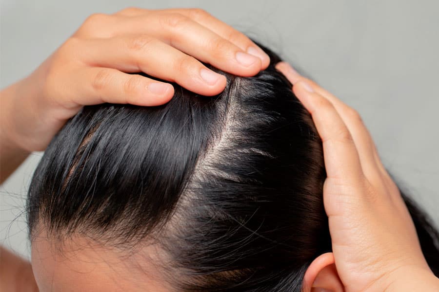 Protección y cuidado del cuero cabelludo utilizando productos especializados de CarasaLab